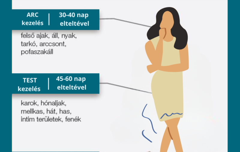 Dióda lézeres alkalmak alakulása a szőrnövekedési idő figyelembevételével 55 Kezelési idő változása a szőrnövekedés figyelembevételével