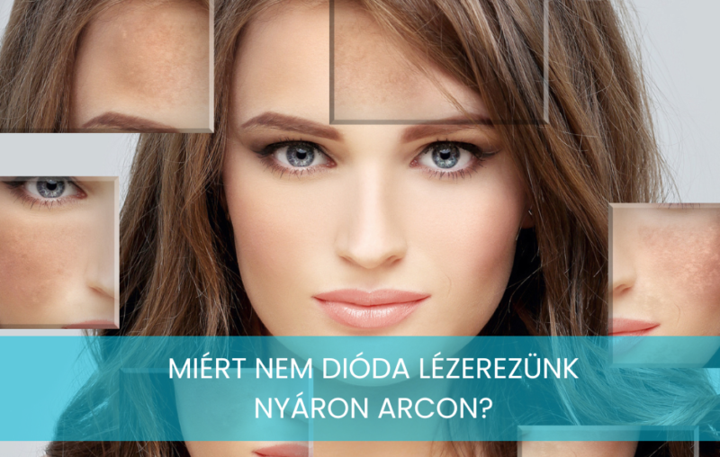 Miért nem szabad az arcon dióda lézerezni nyáron? 47 dióda lézer nyáron arc