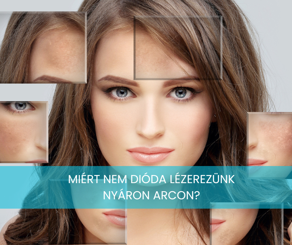 dióda lézer nyáron arc