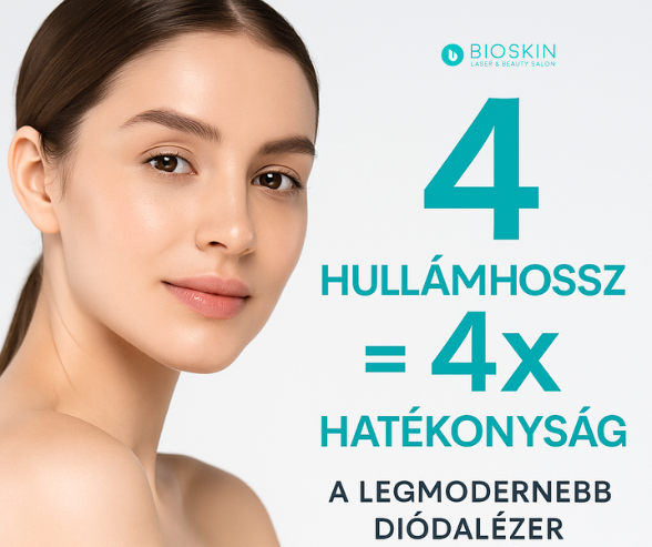 Miért jobb a 4 hullámhosszú diódalézer, mint az egylézeres megoldások? 55 4h 1